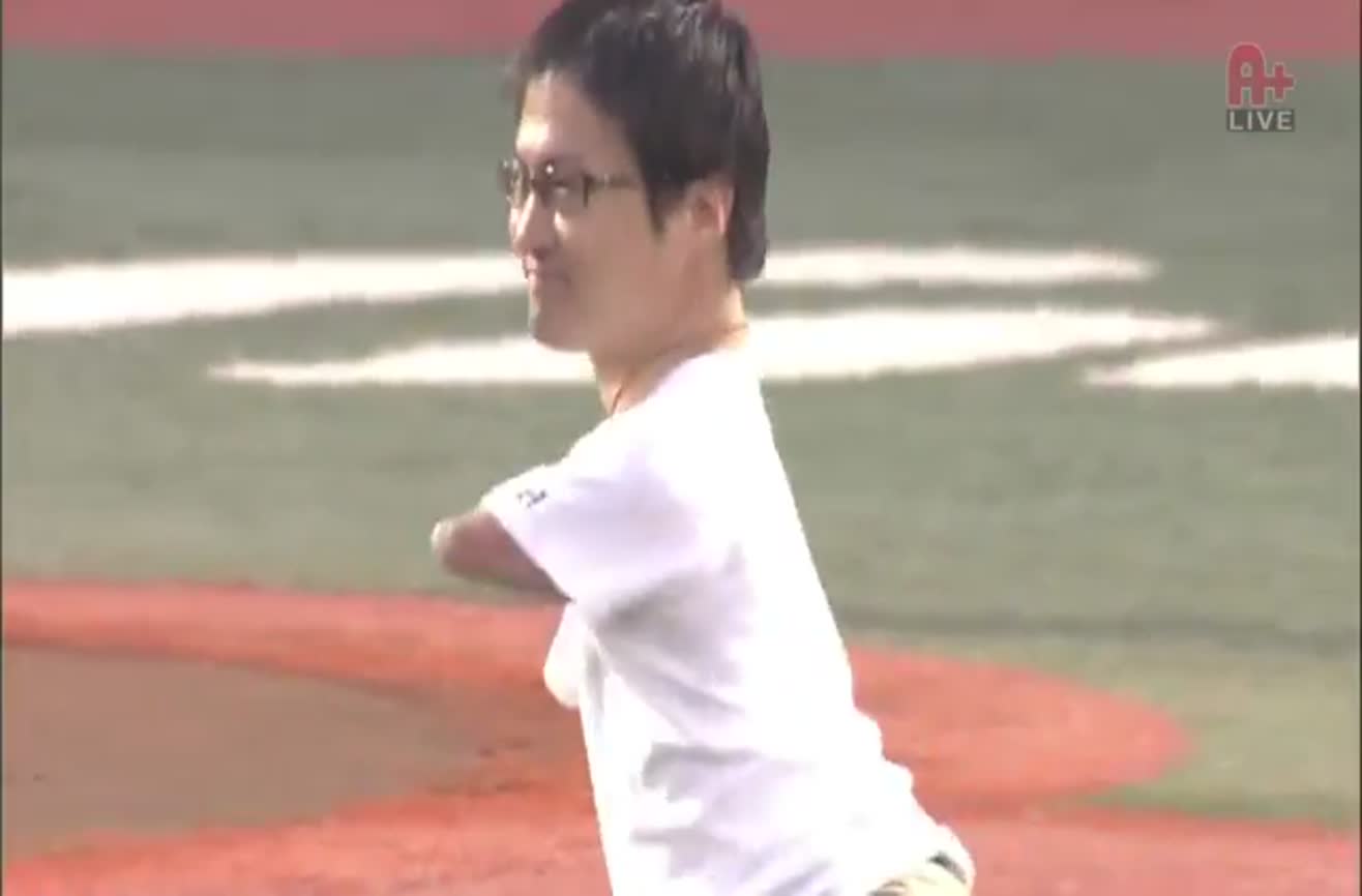 Man with no legs or hands throws his first pitch.