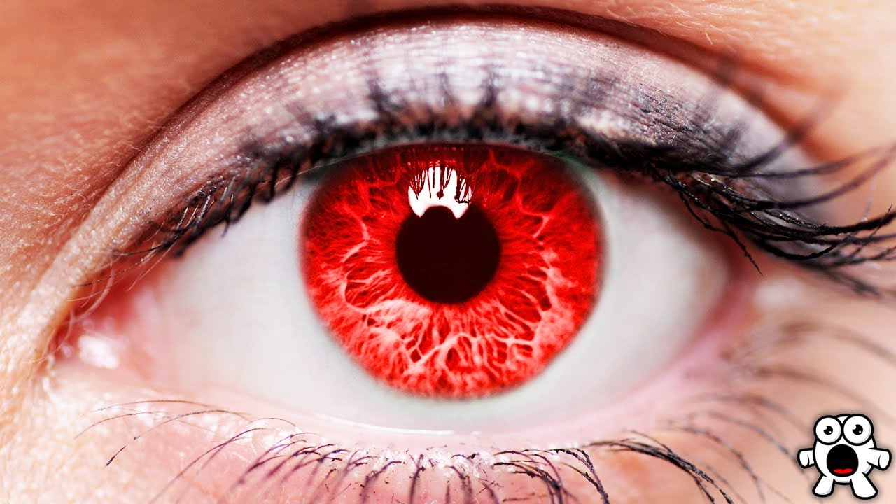 Rarest eye color discount in humans