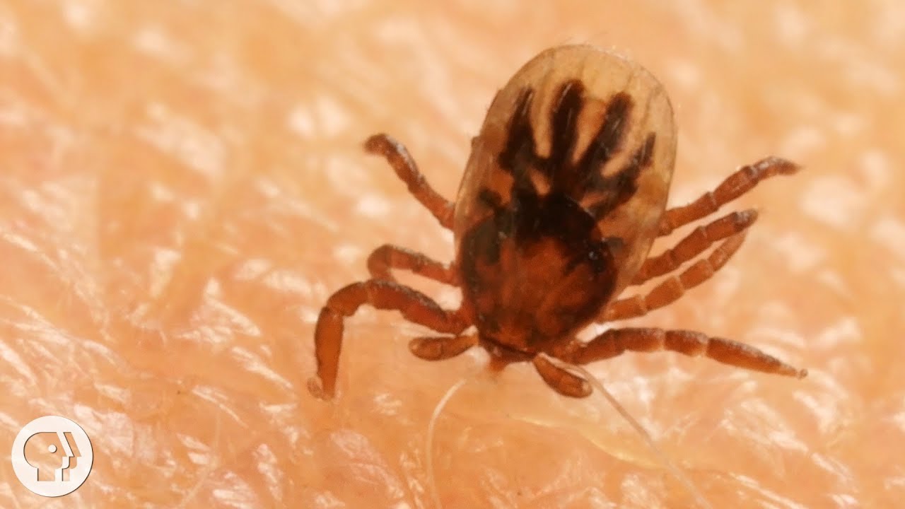 It's Spring, which means prime time for ticks