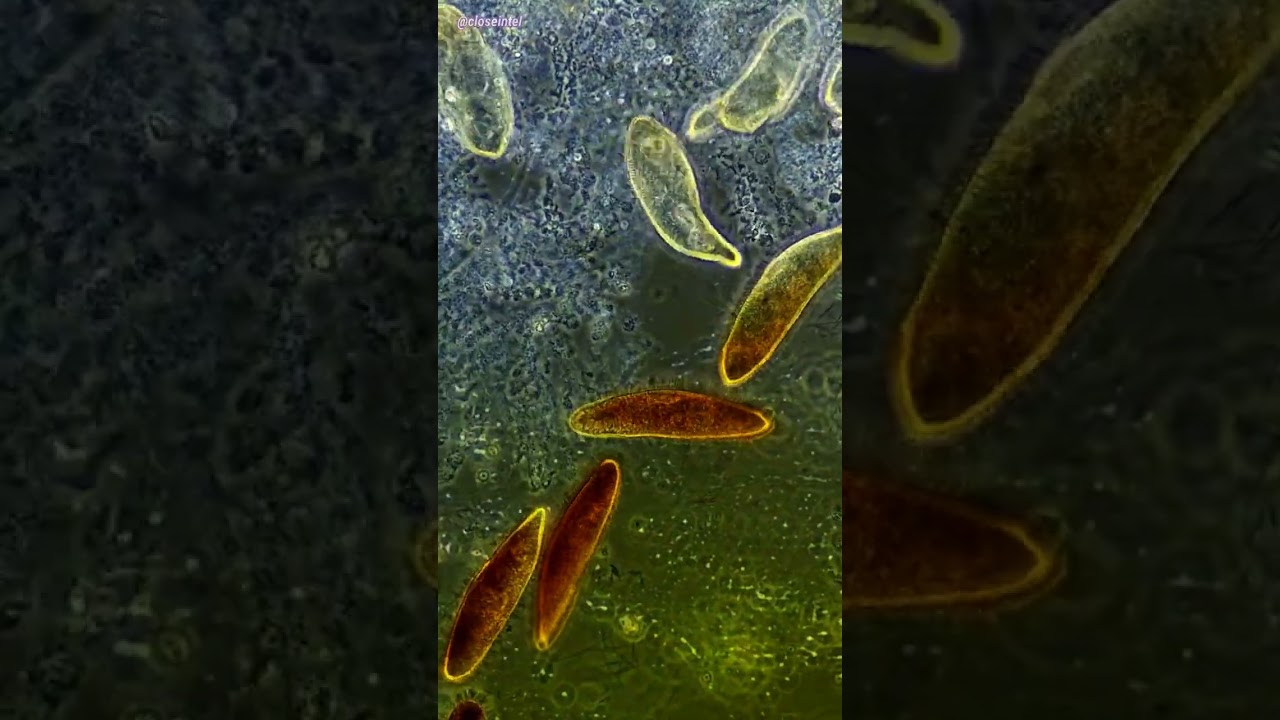 Germs And Iodine Under Microscope